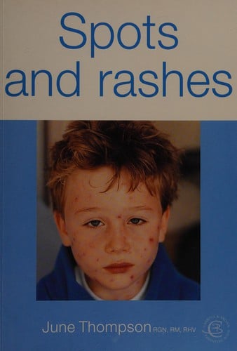 Spots and rashes