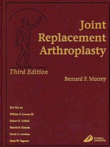 Joint Replacement Arthroplasty