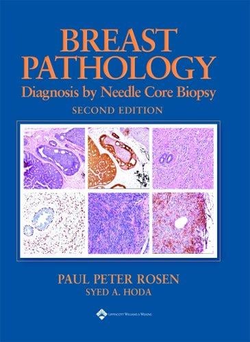 Breast Pathology: Diagnosis by Needle Core Biopsy