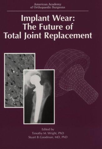 Implant Wear: The Future of Total Joint Replacement (Seminar)