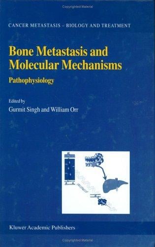 Bone Metastasis and Molecular Mechanisms: Pathophysiology (Cancer Metastasis - Biology and Treatment)