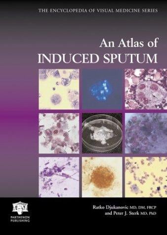 An atlas of induced sputum: an aid for research and diagnosis