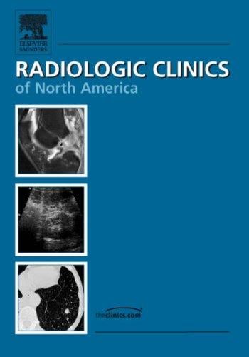Prostate Imaging, An Issue of Radiologic Clinics (The Clinics: Radiology)