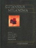 Cutaneous Melanoma