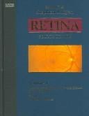 Retina
