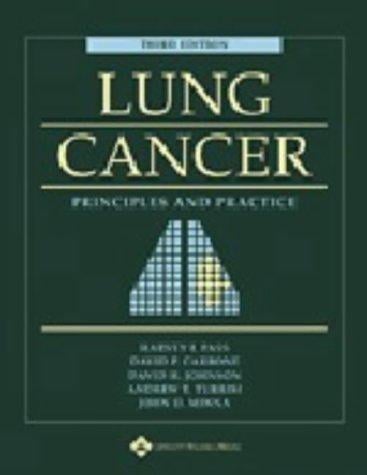 A Lung Cancer: Principles and Practice