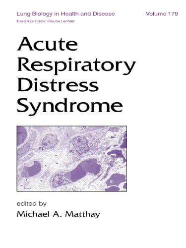 Acute Respiratory Distress Syndrome