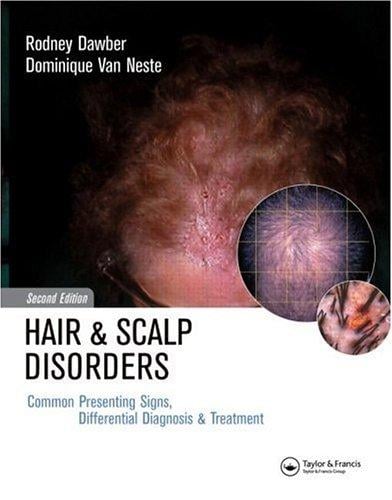 Hair and Scalp Disorders