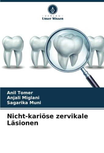 Nicht-kariöse zervikale Läsionen (German Edition)