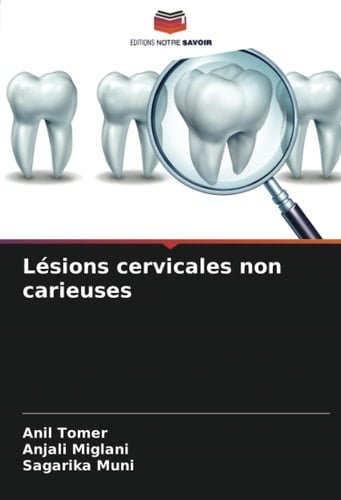 Lésions cervicales non carieuses (French Edition)