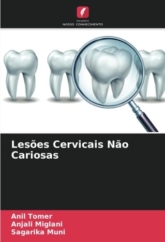 Lesões Cervicais Não Cariosas (Portuguese Edition)