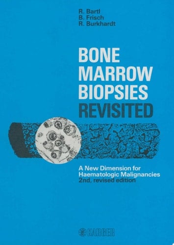 Bone Marrow Biopsies Revisited A New Dimension for Hematologic Malignancies