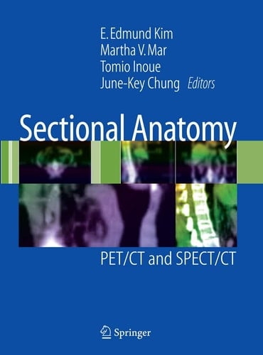 Sectional Anatomy PET/CT and SPECT/CT