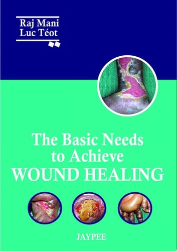 The Basic Needs to Achieve Wound Healing