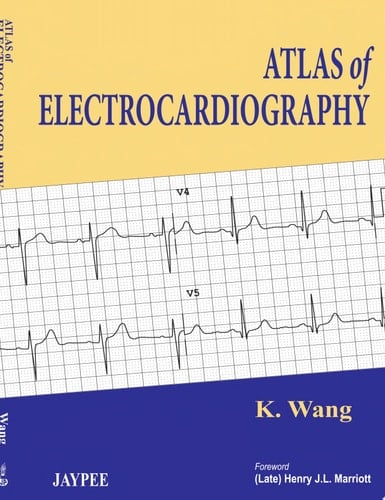 Atlas of Electrocardiography