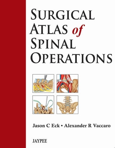 Surgical Atlas of Spinal Operations