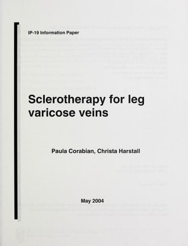 Sclerotherapy for Leg Varicose Veins