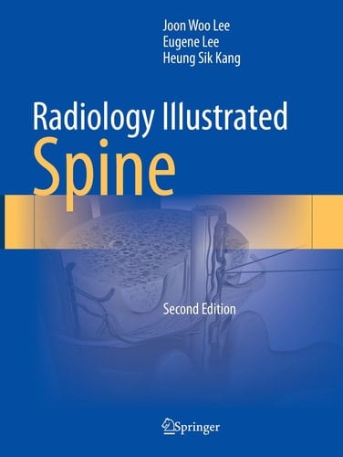 Radiology Illustrated: Spine