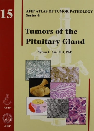 Tumors of the Pituitary Gland