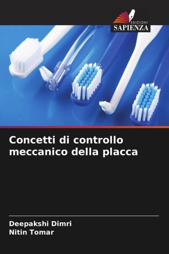 Concetti di controllo meccanico della placca (Italian Edition)