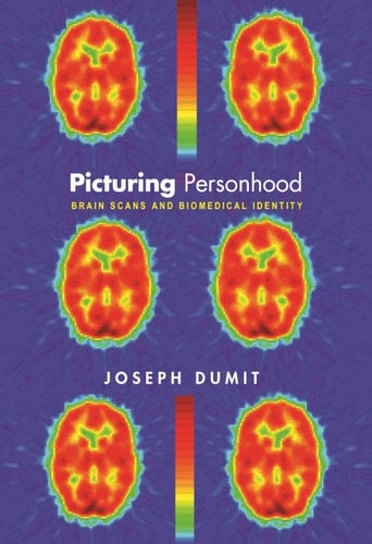 Picturing Personhood Brain Scans and Biomedical Identity