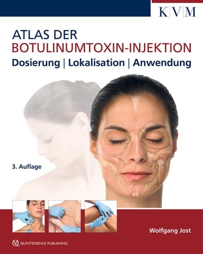 Atlas der Botulinumtoxin-Injektion Dosierung | Lokalisation | Anwendung