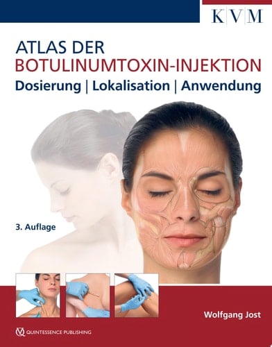 Atlas der Botulinumtoxin-Injektion Dosierung | Lokalisation | Anwendung