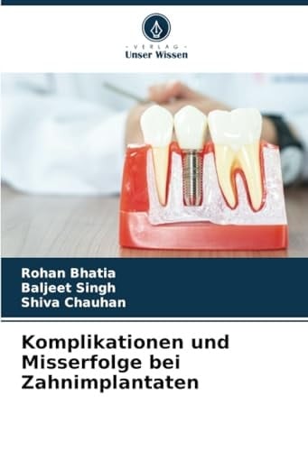 Komplikationen und Misserfolge bei Zahnimplantaten (German Edition)