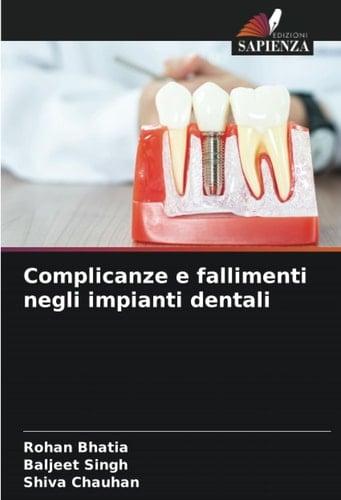 Complicanze e fallimenti negli impianti dentali (Italian Edition)