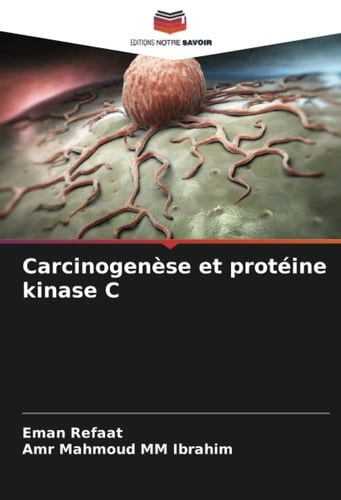 Carcinogenèse et protéine kinase C (French Edition)