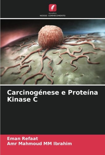 Carcinogénese e Proteína Kinase C (Portuguese Edition)