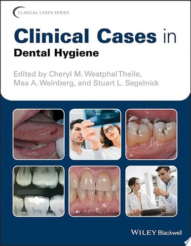 Clinical Cases in Dental Hygiene