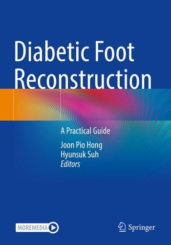 Diabetic Foot Reconstruction A Practical Guide