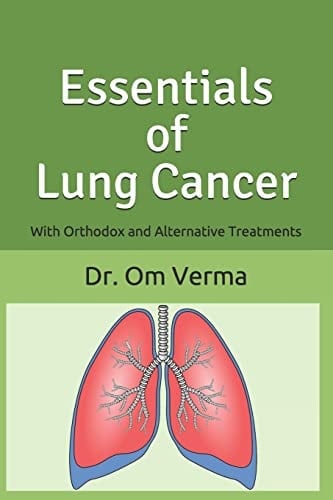 Essentials of Lung Cancer With Orthodox and Alternative Treatments
