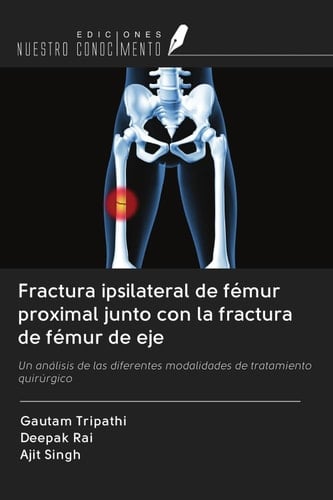 Fractura ipsilateral de fémur proximal junto con la fractura de fémur de eje