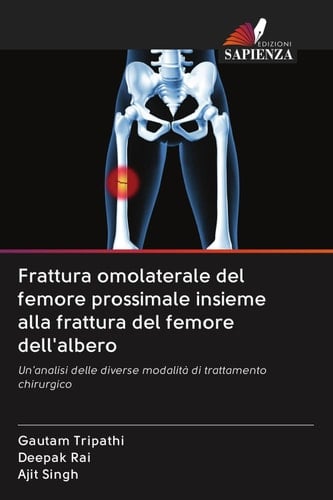 Frattura omolaterale del femore prossimale insieme alla frattura del femore dell'albero: Un'analisi delle diverse modalità di trattamento chirurgico (Italian Edition)