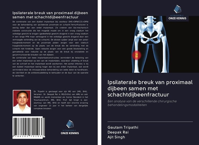 Ipsilaterale breuk van proximaal dijbeen samen met schachtdijbeenfractuur: Een analyse van de verschillende chirurgische behandelingsmodaliteiten (Dutch Edition)