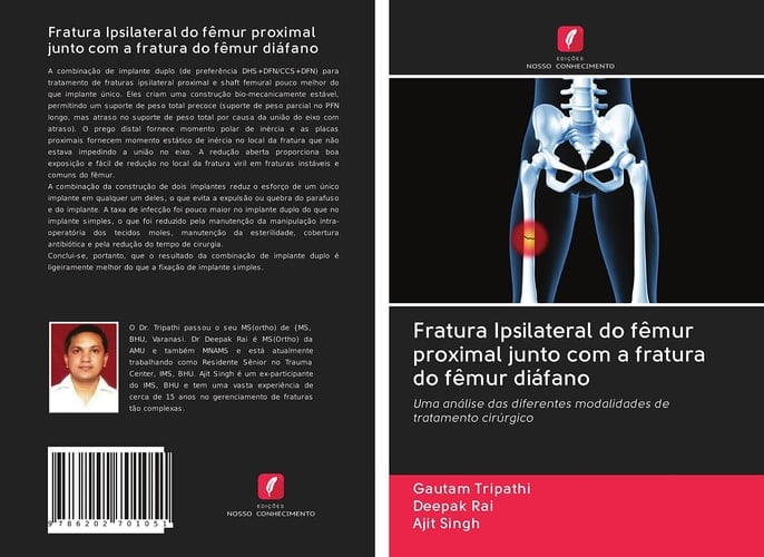 Fratura Ipsilateral do fêmur proximal junto com a fratura do fêmur diáfano: Uma análise das diferentes modalidades de tratamento cirúrgico (Portuguese Edition)