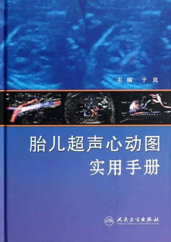 Ultrasonic fetal heartbeat graph Handbook (Chinese Edition)