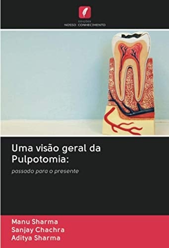 Uma visão geral da Pulpotomia:: passado para o presente (Portuguese Edition)