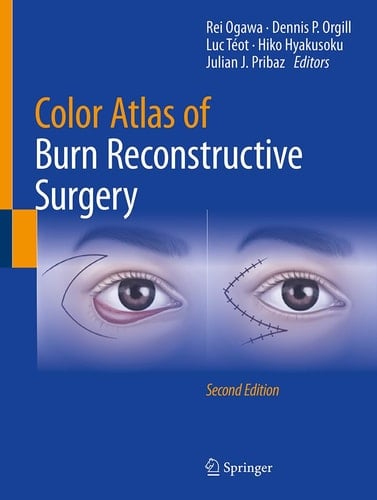 Color Atlas of Burn Reconstructive Surgery