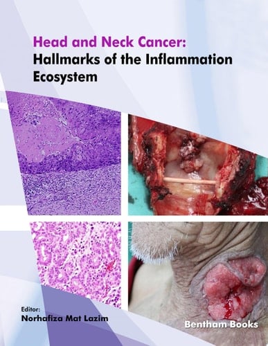 Head and Neck Cancer: Hallmarks of the Inflammation Ecosystem