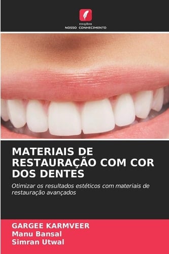 Materiais de Restauração Com Cor DOS Dentes (Portuguese Edition)