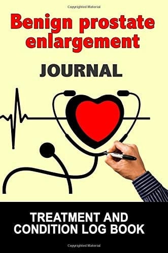 Benign Prostate Enlargement Journal Treatment and Condition Log Book, 150 College-Ruled Pages