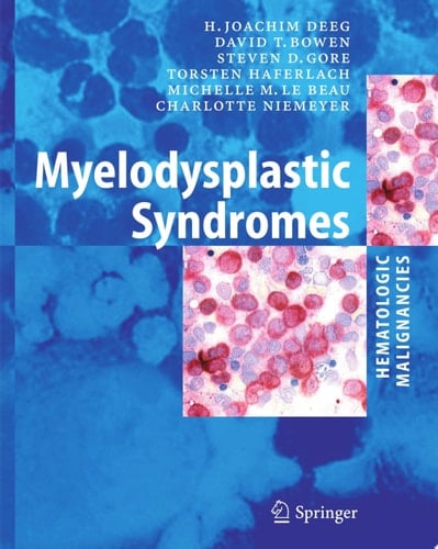 Myelodysplastic Syndromes