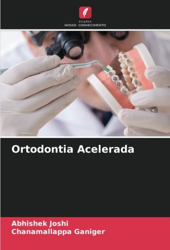 Ortodontia Acelerada (Portuguese Edition)