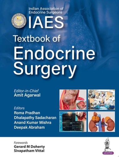 Textbook of Endocrine Surgery