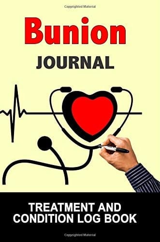 Bunion Journal Treatment and Condition Log Book, 150 College-Ruled Pages