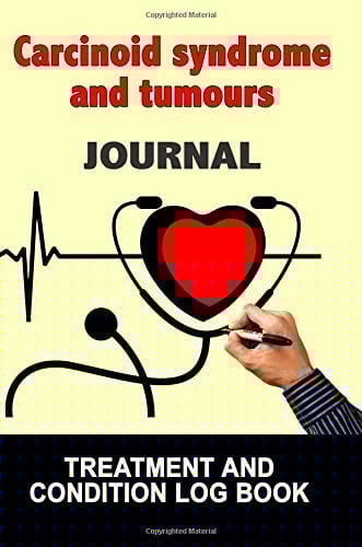 Carcinoid Syndrome and Tumours Journal Treatment and Condition Log Book, 150 College-Ruled Pages