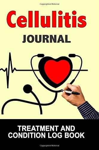 Cellulitis Journal Treatment and Condition Log Book, 150 College-Ruled Pages